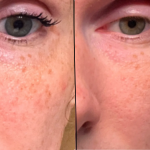 The Girlyness™ 4-in-1 Facial Wand