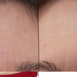 The Girlyness™ 4-in-1 Facial Wand