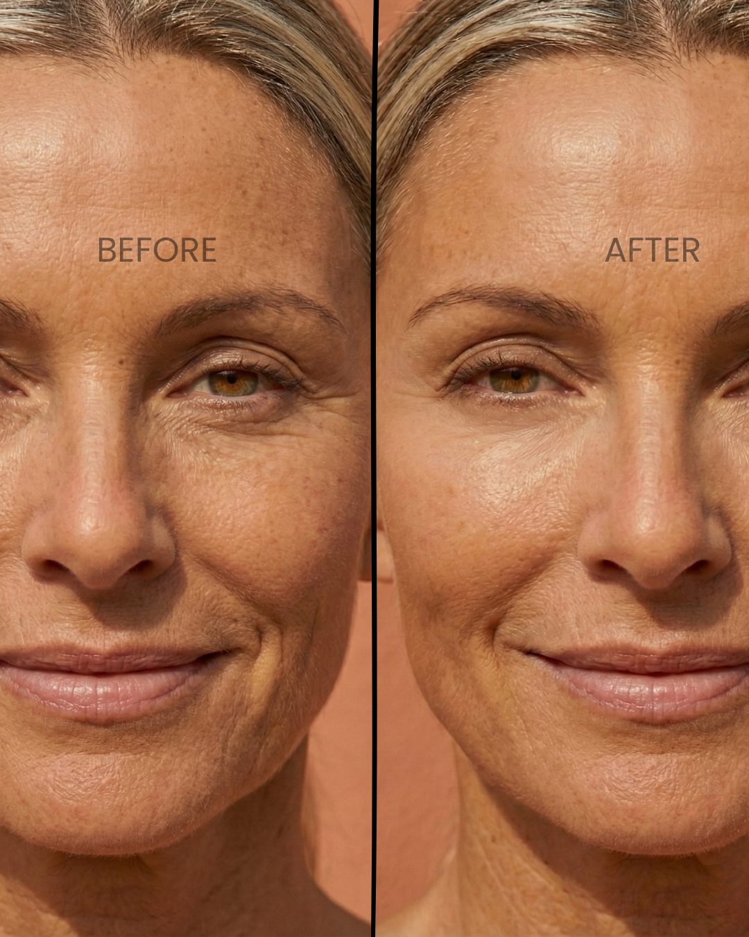 The Girlyness™ 4-in-1 Facial Wand